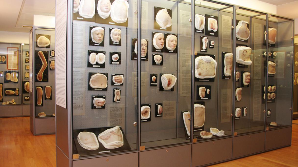 Le vetrine nel Moulagenmuseum dell'università e dell'ospedale universitario di Zurigo