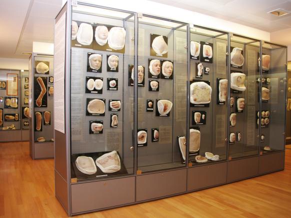 Le vetrine nel Moulagenmuseum dell'università e dell'ospedale universitario di Zurigo
